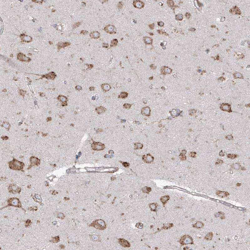 PDIA6 Antibody - BSA Free Immunohistochemistry-Paraffin: PDIA6 Antibody - BSA Free [NBP1-84798]