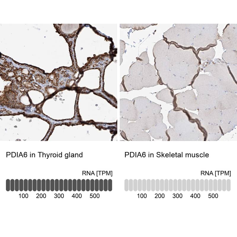 PDIA6 Antibody - BSA Free Immunohistochemistry-Paraffin: PDIA6 Antibody - BSA Free [NBP1-84798]