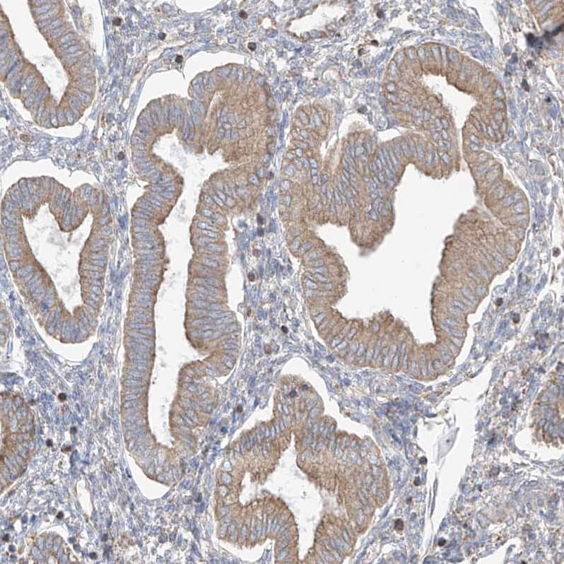 PDIA6 Antibody - BSA Free Immunohistochemistry-Paraffin: PDIA6 Antibody - BSA Free [NBP1-84798]