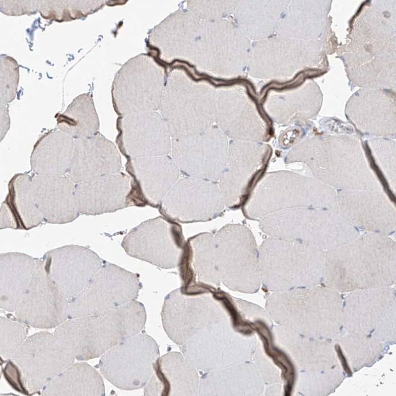 PDIA6 Antibody - BSA Free Immunohistochemistry-Paraffin: PDIA6 Antibody - BSA Free [NBP1-84798]