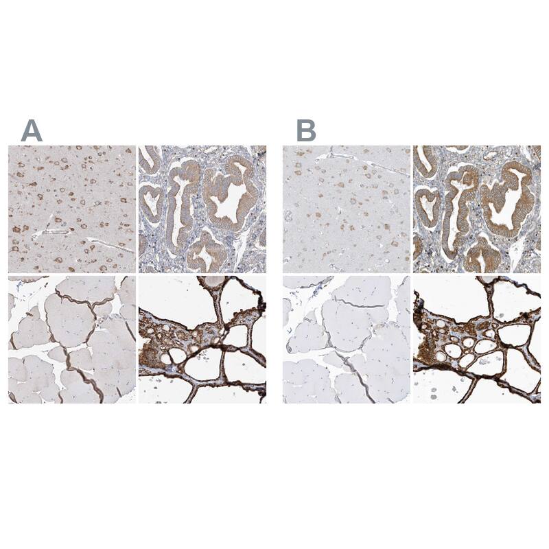PDIA6 Antibody - BSA Free Immunohistochemistry-Paraffin: PDIA6 Antibody - BSA Free [NBP1-84798]