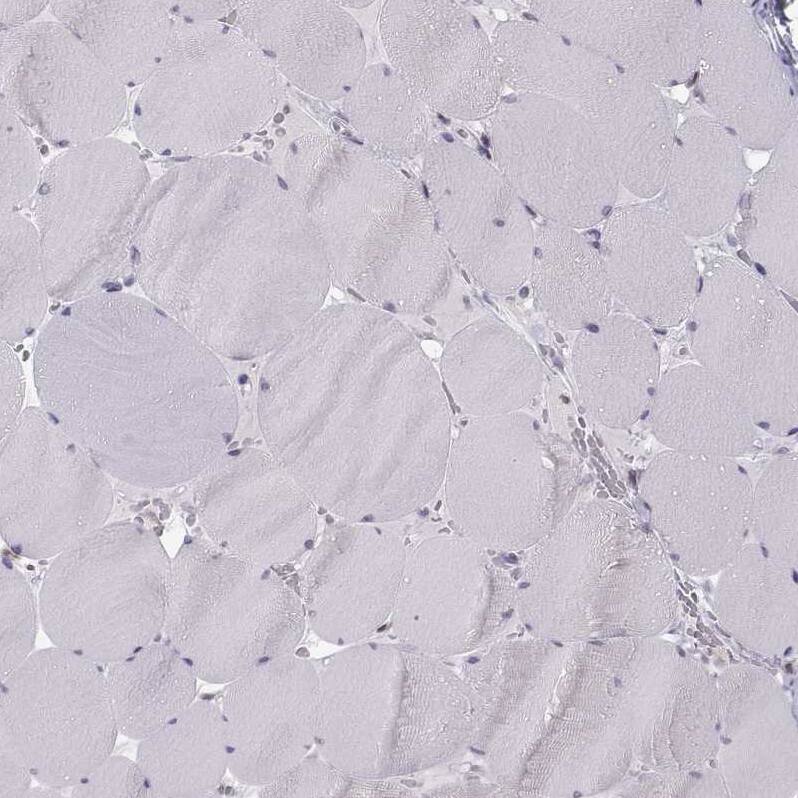 ERO1L Antibody - BSA Free Immunohistochemistry-Paraffin: ERO1L Antibody - BSA Free [NBP1-84800]