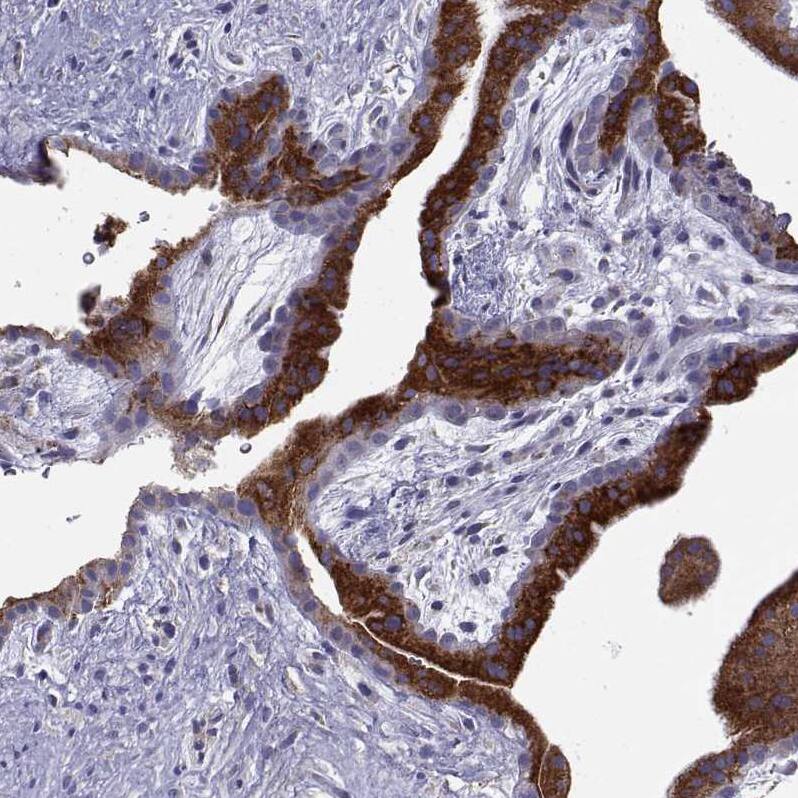 ERO1L Antibody - BSA Free Immunohistochemistry-Paraffin: ERO1L Antibody - BSA Free [NBP1-84800]
