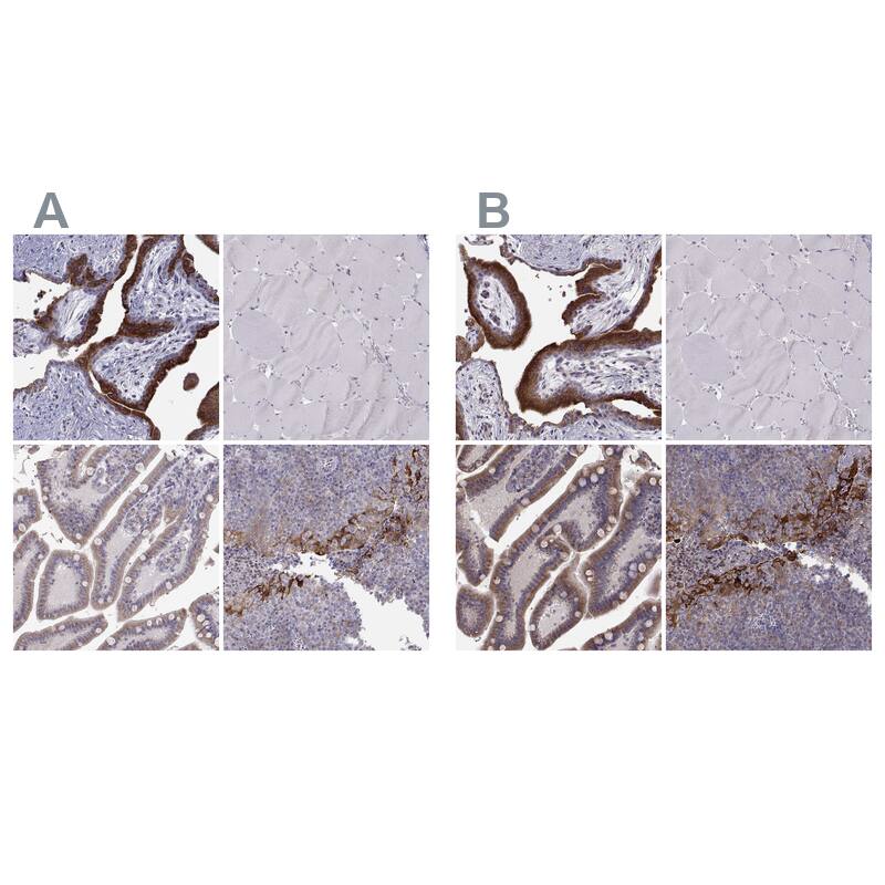 ERO1L Antibody - BSA Free Immunohistochemistry-Paraffin: ERO1L Antibody - BSA Free [NBP1-84800]