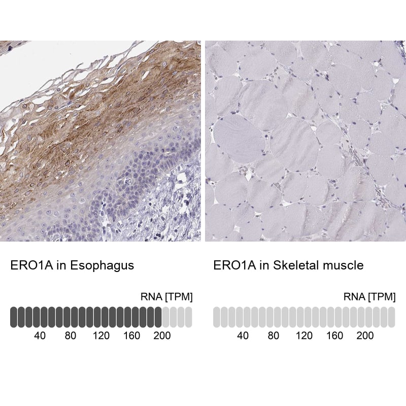 ERO1L Antibody - BSA Free Immunohistochemistry-Paraffin: ERO1L Antibody - BSA Free [NBP1-84800]