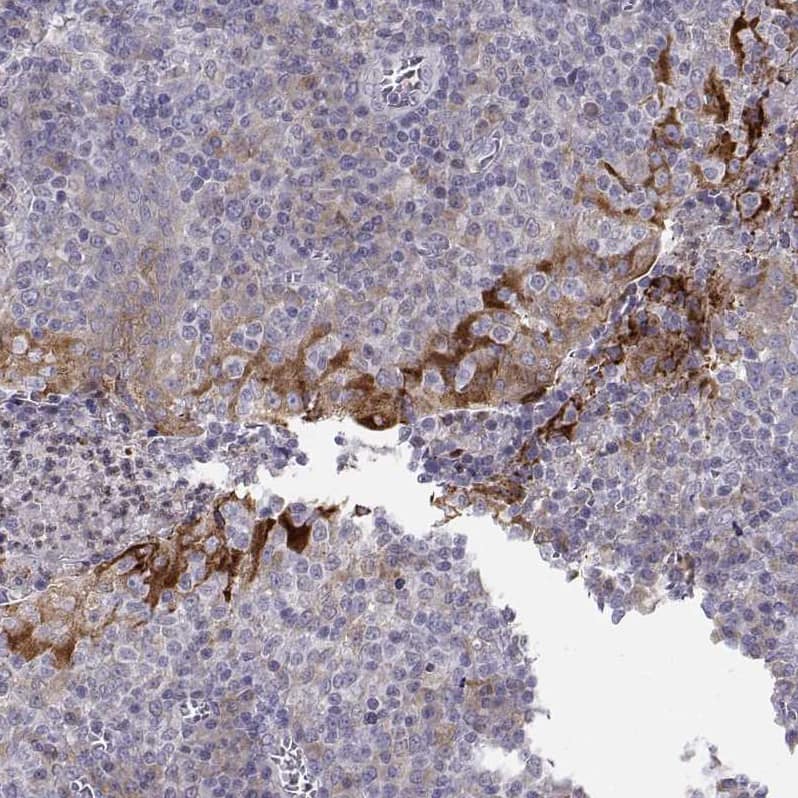 ERO1L Antibody - BSA Free Immunohistochemistry-Paraffin: ERO1L Antibody - BSA Free [NBP1-84800]