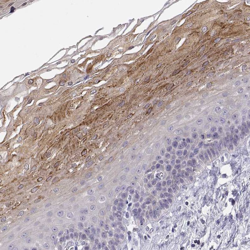 ERO1L Antibody - BSA Free Immunohistochemistry-Paraffin: ERO1L Antibody - BSA Free [NBP1-84800]