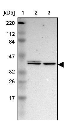 ERK1 Antibody - BSA Free Western Blot: ERK1 Antibody - BSA Free [NBP1-84807]