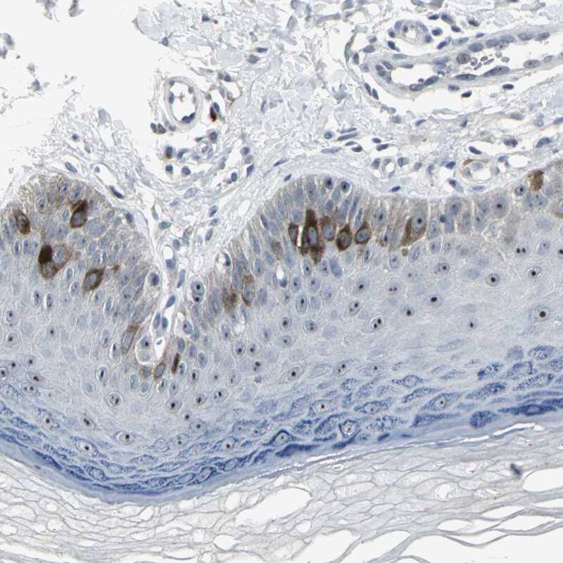 TACC3 Antibody - BSA Free Immunohistochemistry-Paraffin: TACC3 Antibody [NBP1-84811]