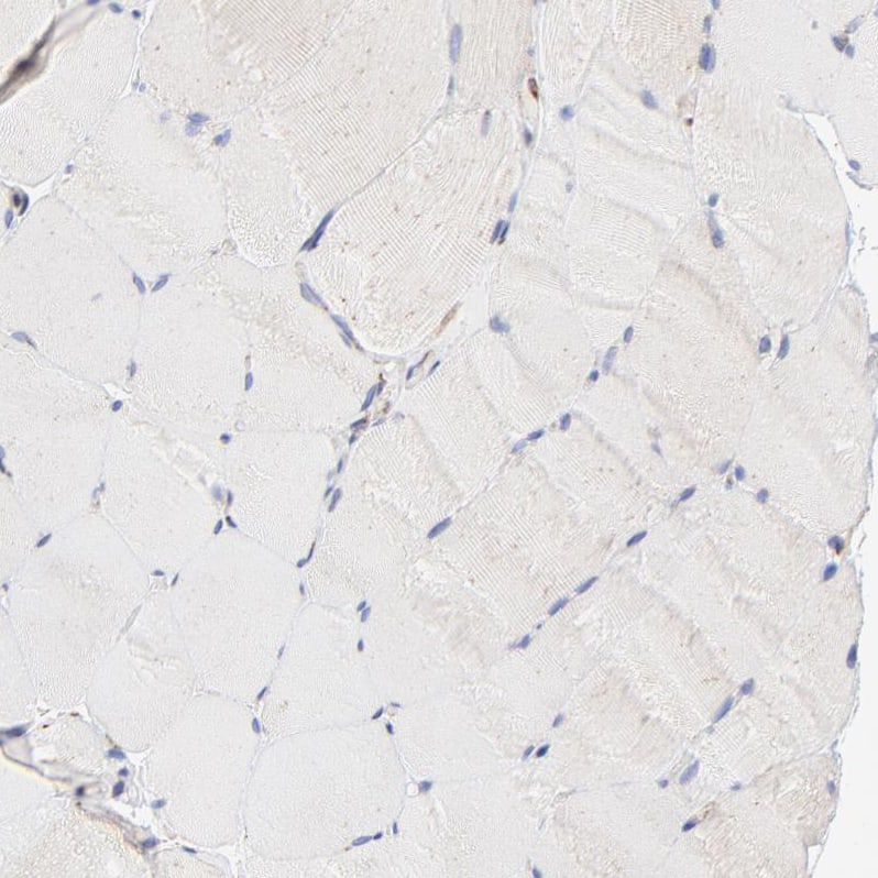 LMAN1 Antibody - BSA Free Immunohistochemistry-Paraffin: LMAN1 Antibody - BSA Free [NBP1-84812]
