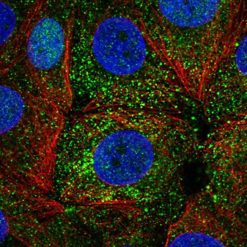 ER alpha/NR3A1 Antibody - BSA Free Immunocytochemistry/ Immunofluorescence: ER alpha/NR3A1 Antibody [NBP1-84827]