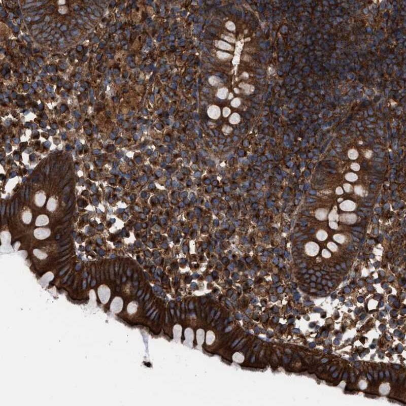 EPS15R Antibody - BSA Free Immunohistochemistry-Paraffin: EPS15R Antibody [NBP1-84828]