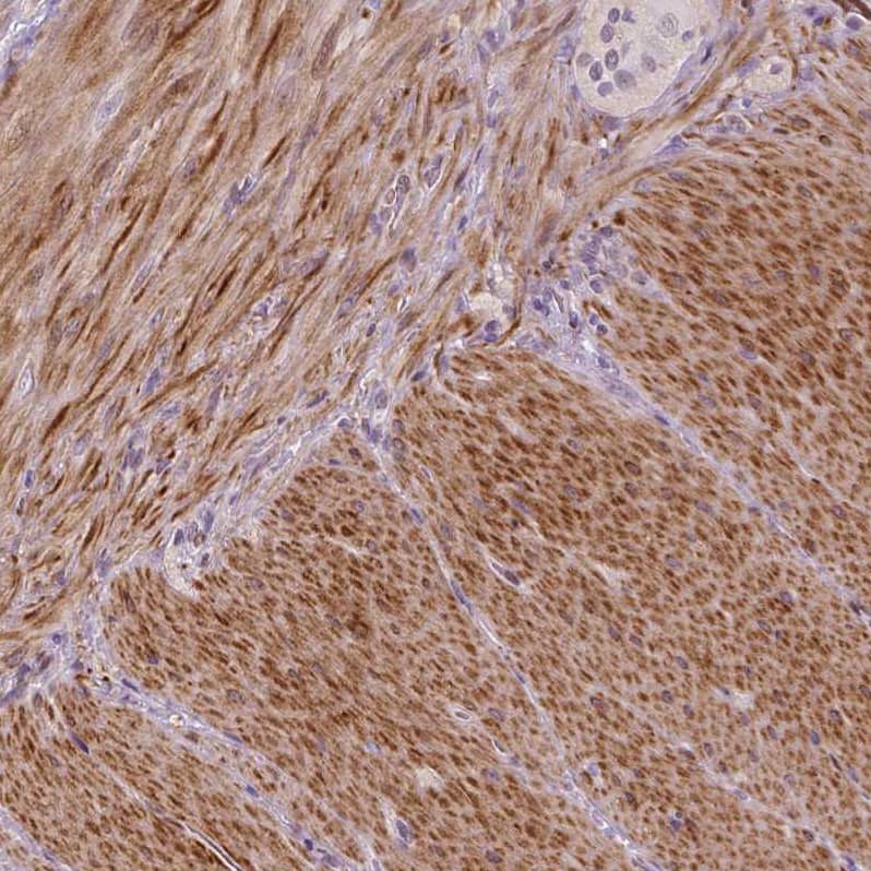 PTGER3 Antibody - BSA Free Immunohistochemistry-Paraffin: PTGER3 Antibody - BSA Free [NBP1-84835]