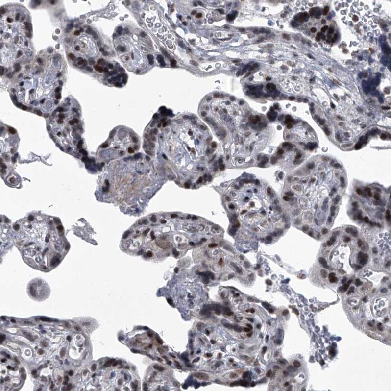MLLT1 Antibody - BSA Free Immunohistochemistry-Paraffin: MLLT1 Antibody - BSA Free [NBP1-84840]