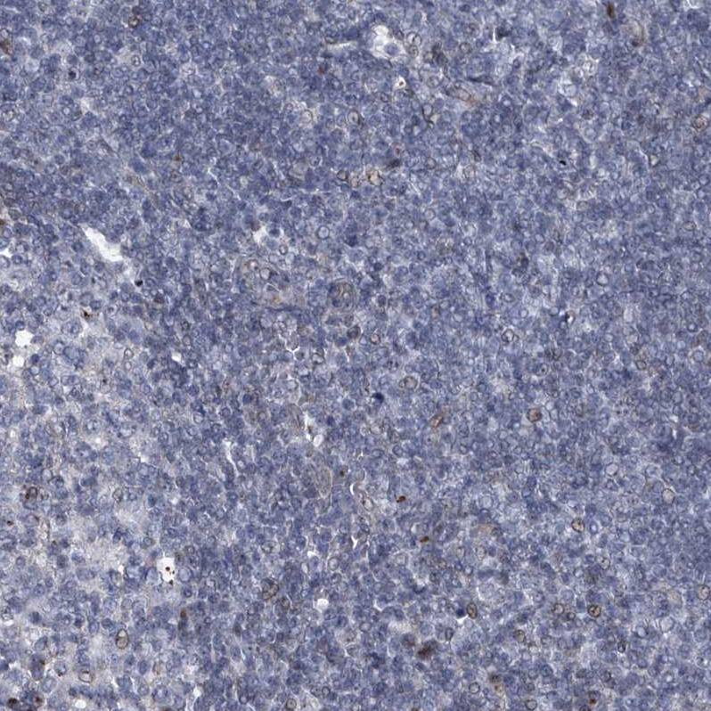 MLLT1 Antibody - BSA Free Immunohistochemistry-Paraffin: MLLT1 Antibody - BSA Free [NBP1-84840]