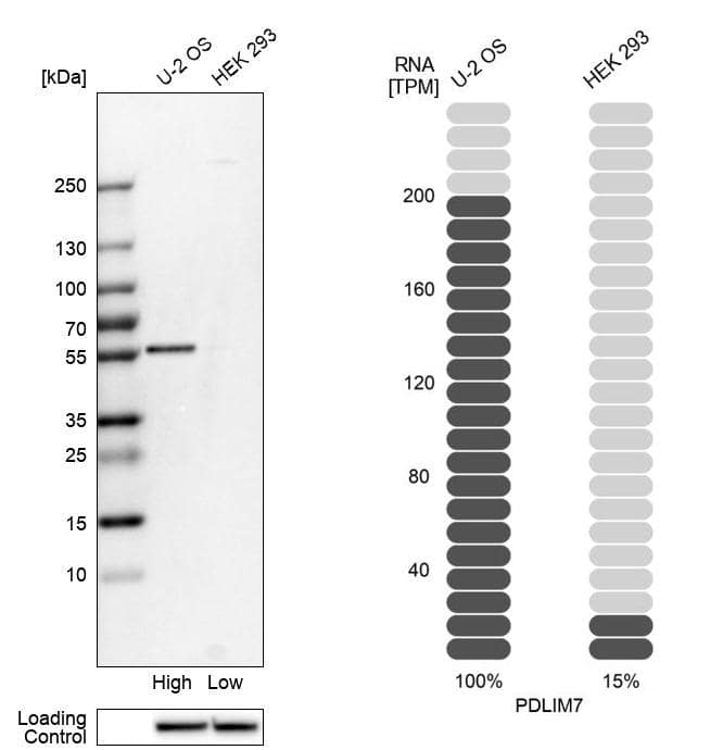 PDLIM7 Antibody - BSA Free Western Blot: PDLIM7 Antibody - BSA Free [NBP1-84841]