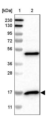 RPS14 Antibody - BSA Free Western Blot: RPS14 Antibody - BSA Free [NBP1-84847]