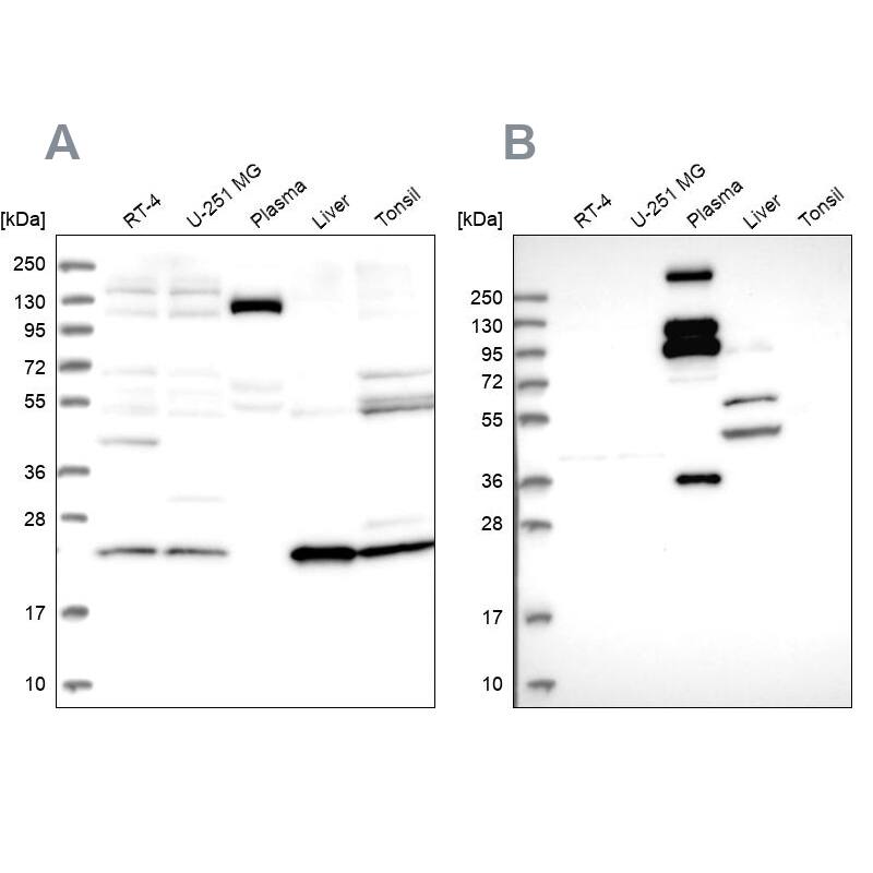 REXO1 Antibody Western Blot: REXO1 Antibody Antibody [NBP1-84862]