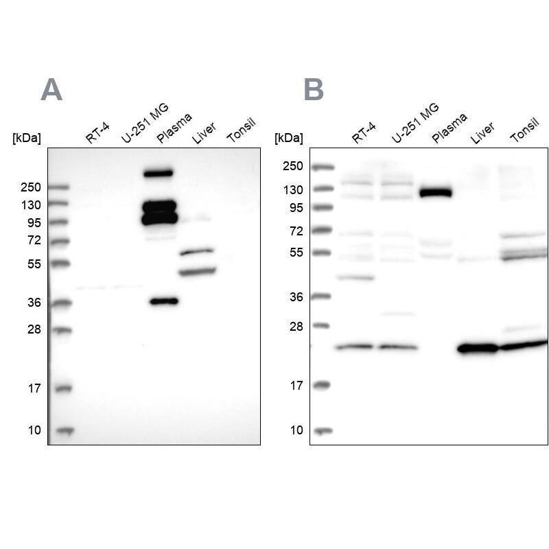 REXO1 Antibody Western Blot: REXO1 Antibody Antibody [NBP1-84863]