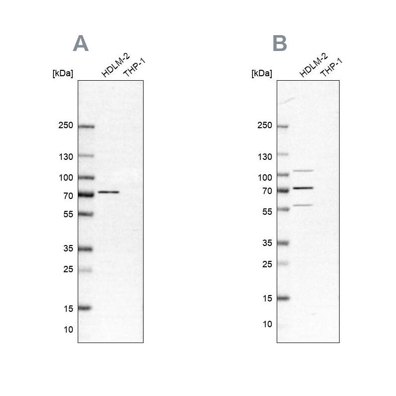 PKR Antibody Western Blot: PKR Antibody Antibody [NBP1-84878]