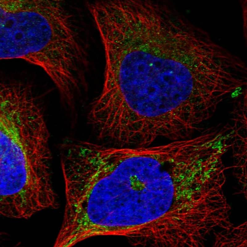 eIF2A Antibody - BSA Free Immunocytochemistry/ Immunofluorescence: eIF2A Antibody [NBP1-84879]