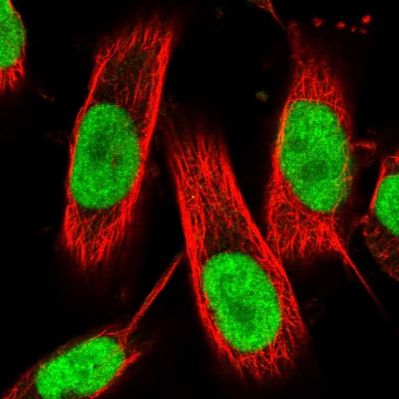 ZNF521 Antibody - BSA Free Immunocytochemistry/ Immunofluorescence: ZNF521 Antibody [NBP1-84883]