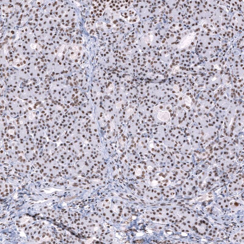 SNRPN Antibody Immunohistochemistry-Paraffin: SNRPN Antibody [NBP1-83280]