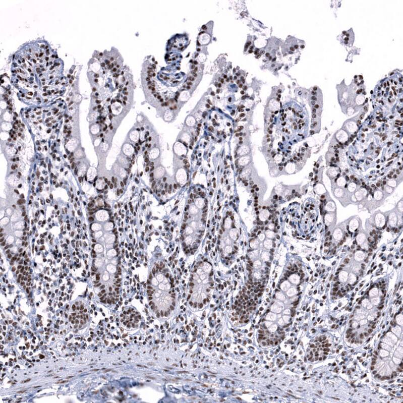 SNRPN Antibody Immunohistochemistry-Paraffin: SNRPN Antibody [NBP1-83280]
