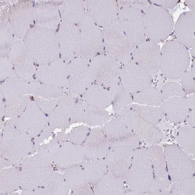 PSG4 Antibody Immunohistochemistry-Paraffin: PSG4 Antibody [NBP2-33461]