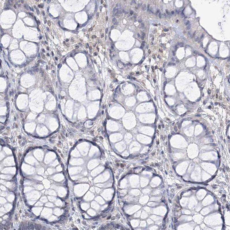 Centrin 2 Antibody Immunohistochemistry-Paraffin: Centrin 2 Antibody [NBP1-88213]