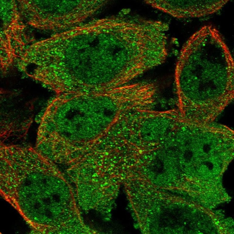 RUVBL1 Antibody - BSA Free Immunocytochemistry/ Immunofluorescence: RUVBL1 Antibody [NBP1-84914]