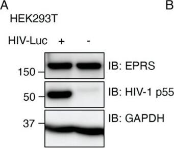 EPRS Antibody - BSA Free