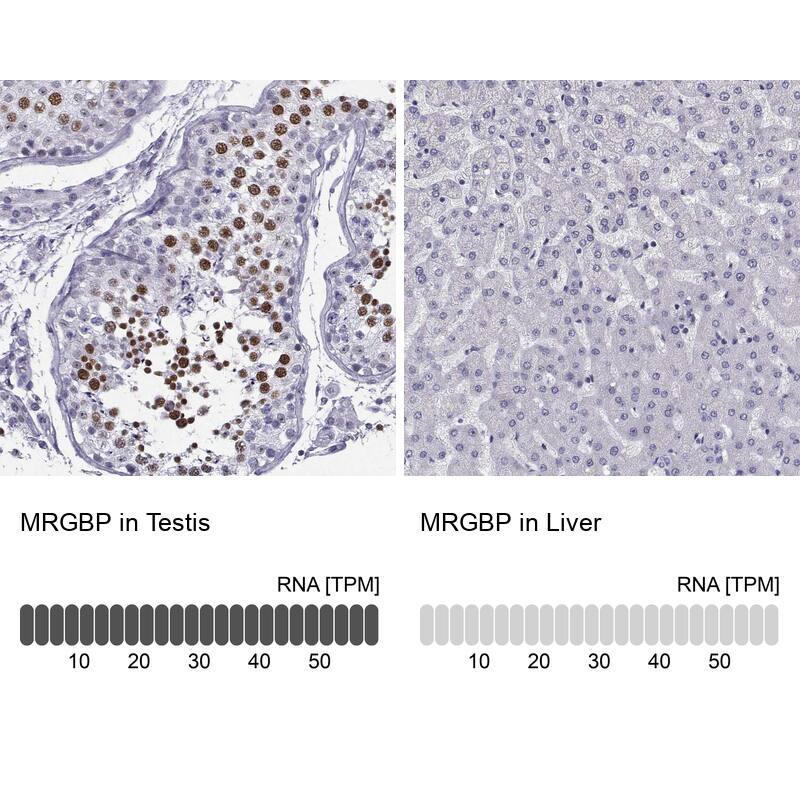 MRG-binding protein Antibody - BSA Free Immunohistochemistry-Paraffin: MRG-binding protein Antibody [NBP1-84936]