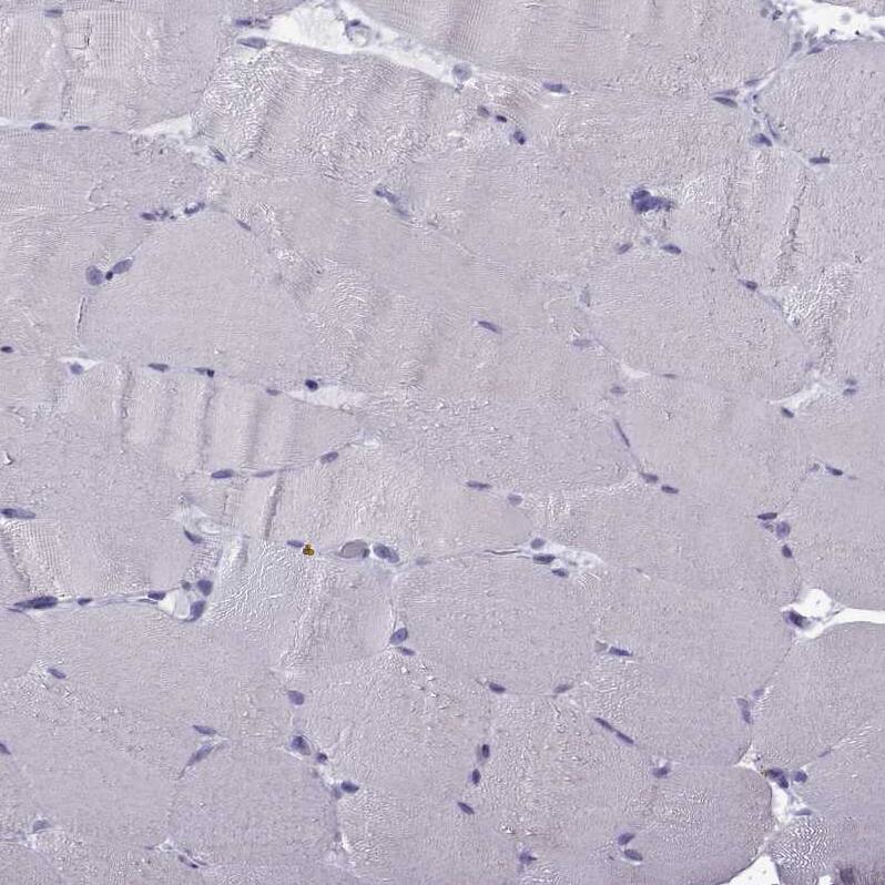 MRG-binding protein Antibody - BSA Free Immunohistochemistry-Paraffin: MRG-binding protein Antibody [NBP1-84936]