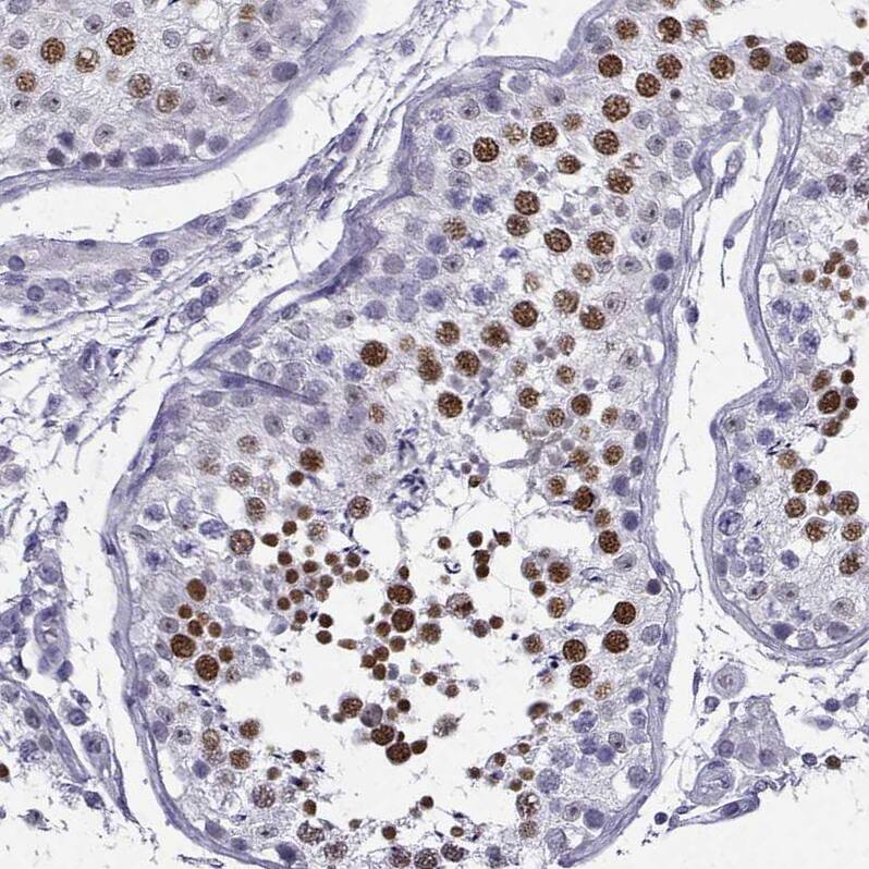 MRG-binding protein Antibody - BSA Free Immunohistochemistry-Paraffin: MRG-binding protein Antibody [NBP1-84936]