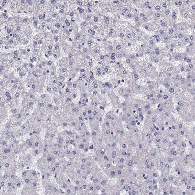 MRG-binding protein Antibody - BSA Free Immunohistochemistry-Paraffin: MRG-binding protein Antibody [NBP1-84936]