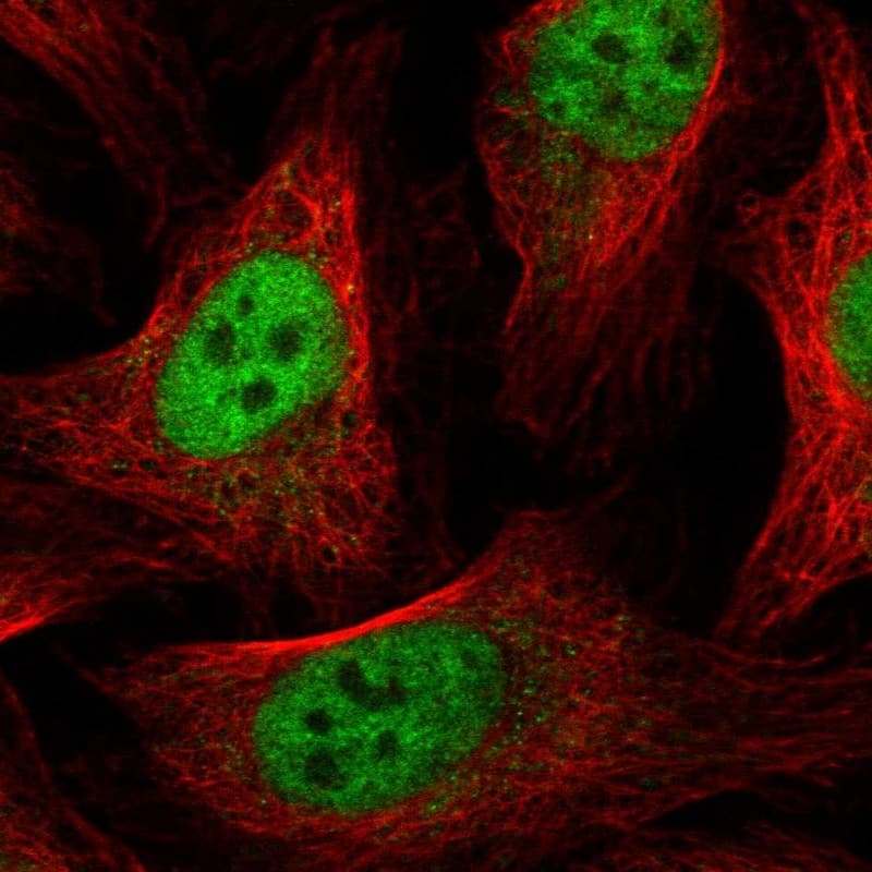 GABPA Antibody - BSA Free Immunocytochemistry/ Immunofluorescence: GABPA Antibody [NBP1-84941]