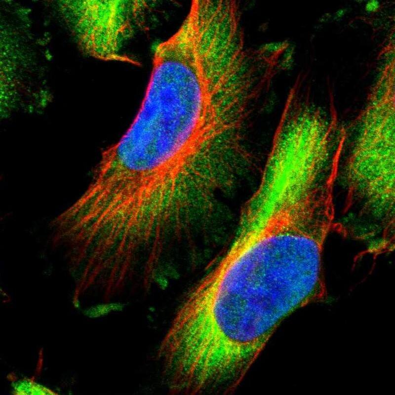 HSPB8/HSP22 Antibody - BSA Free Immunocytochemistry/ Immunofluorescence: HSPB8/HSP22 Antibody [NBP1-84945]