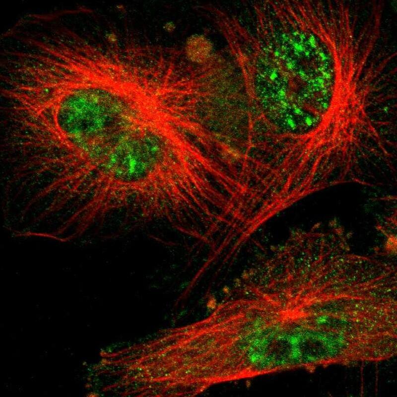 UBE2R1/CDC34 Antibody - BSA Free Immunocytochemistry/ Immunofluorescence: UBE2R1/CDC34 Antibody [NBP1-84946]