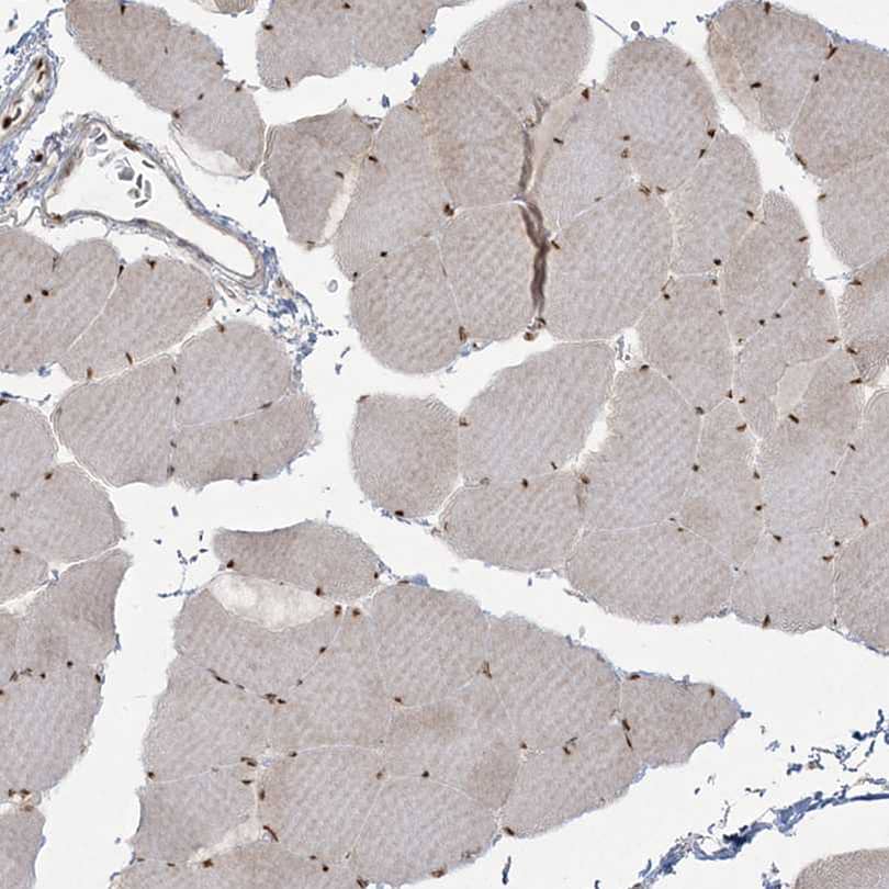 RBM10 Antibody - BSA Free Immunohistochemistry-Paraffin: RBM10 Antibody [NBP1-84951]