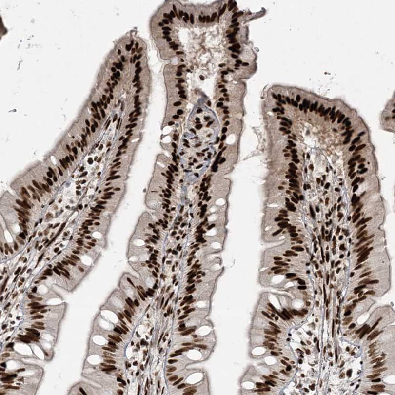 RBM10 Antibody - BSA Free Immunohistochemistry-Paraffin: RBM10 Antibody [NBP1-84951]