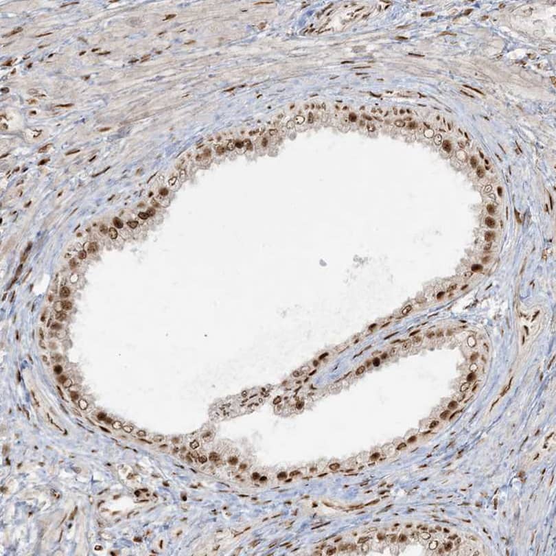 RBM10 Antibody - BSA Free Immunohistochemistry-Paraffin: RBM10 Antibody [NBP1-84951]