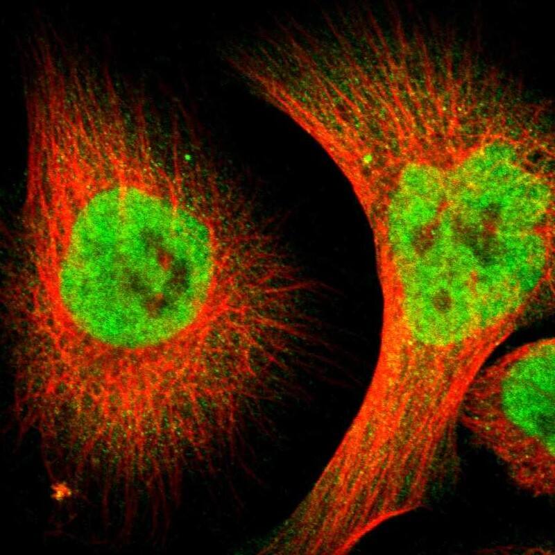 ZMYM3 Antibody - BSA Free Immunocytochemistry/ Immunofluorescence: ZMYM3 Antibody [NBP1-84952]