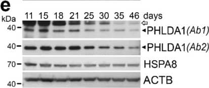 PHLDA1 Antibody