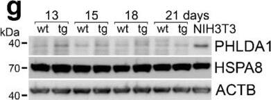 PHLDA1 Antibody