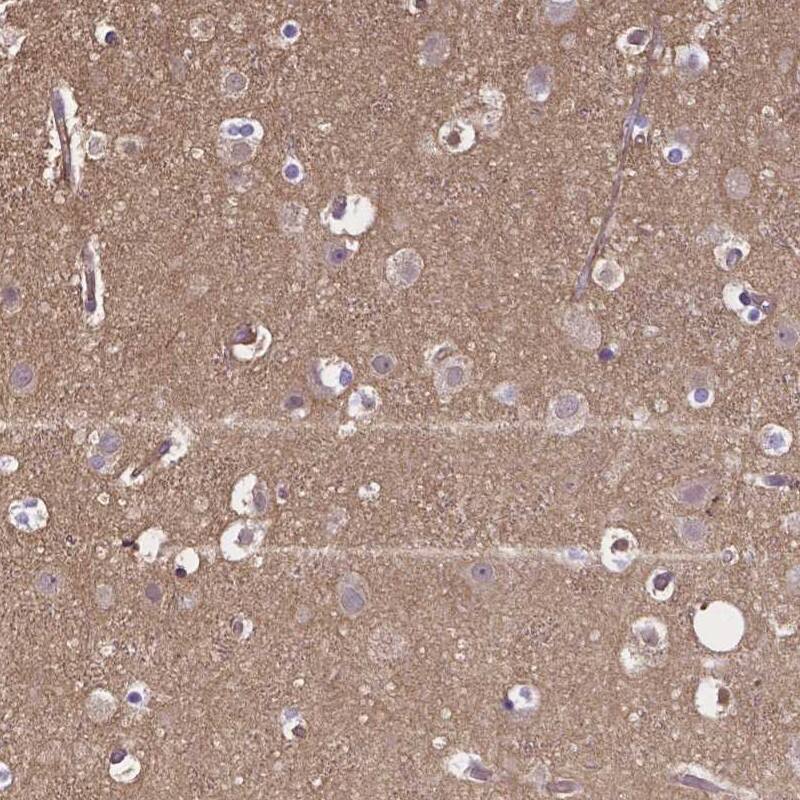 CRMP1 Antibody - BSA Free Immunohistochemistry-Paraffin: CRMP1 Antibody [NBP1-84985]