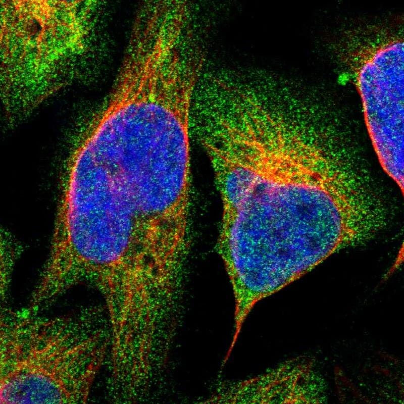 PLAP Antibody - BSA Free Immunocytochemistry/ Immunofluorescence: PLAP Antibody [NBP1-84997]