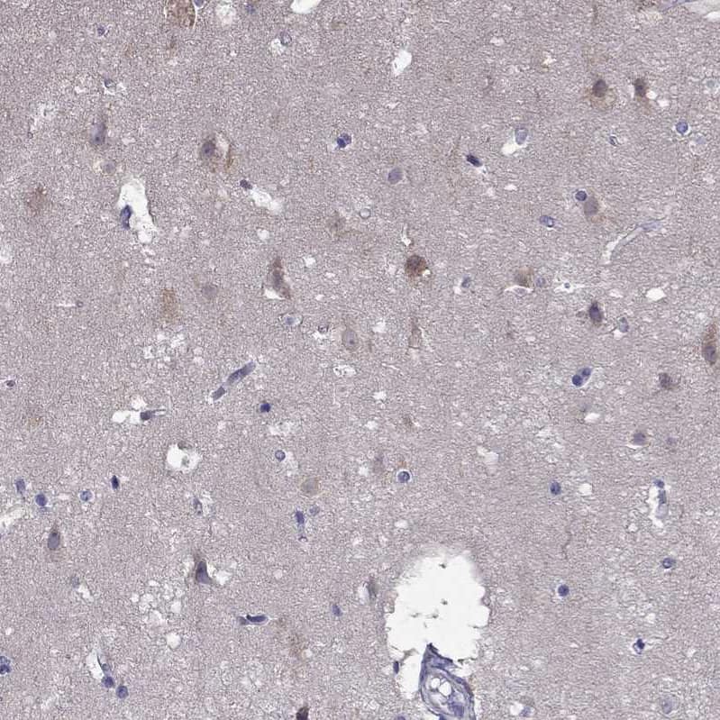 SCNN1D Antibody - BSA Free Immunohistochemistry-Paraffin: SCNN1D Antibody [NBP1-85004]