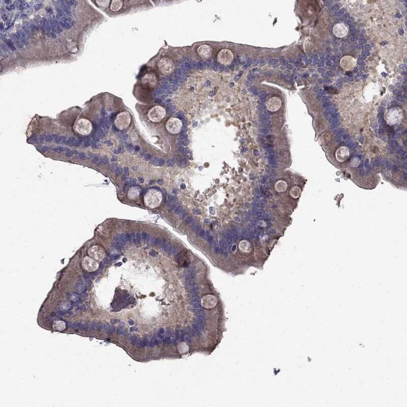 SCNN1D Antibody - BSA Free Immunohistochemistry-Paraffin: SCNN1D Antibody [NBP1-85004]