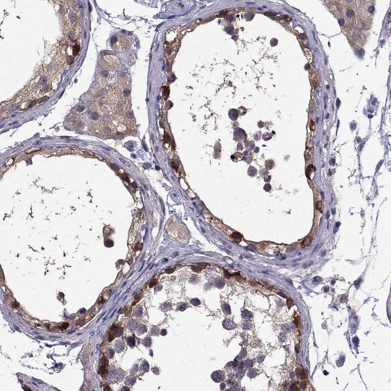 SCNN1D Antibody - BSA Free Immunohistochemistry-Paraffin: SCNN1D Antibody [NBP1-85004]